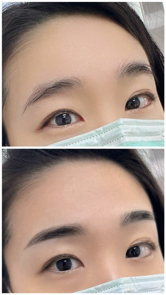 霧眉