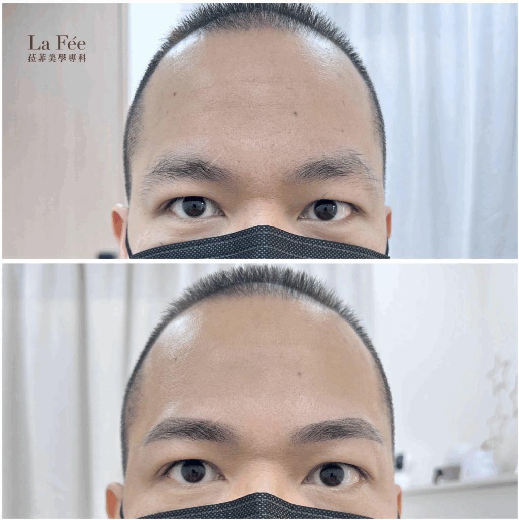 男生霧眉